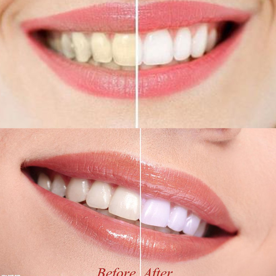 Bamboo Charcoal Teeth Tooth De - огляд і ціна Teeth Whitening Co