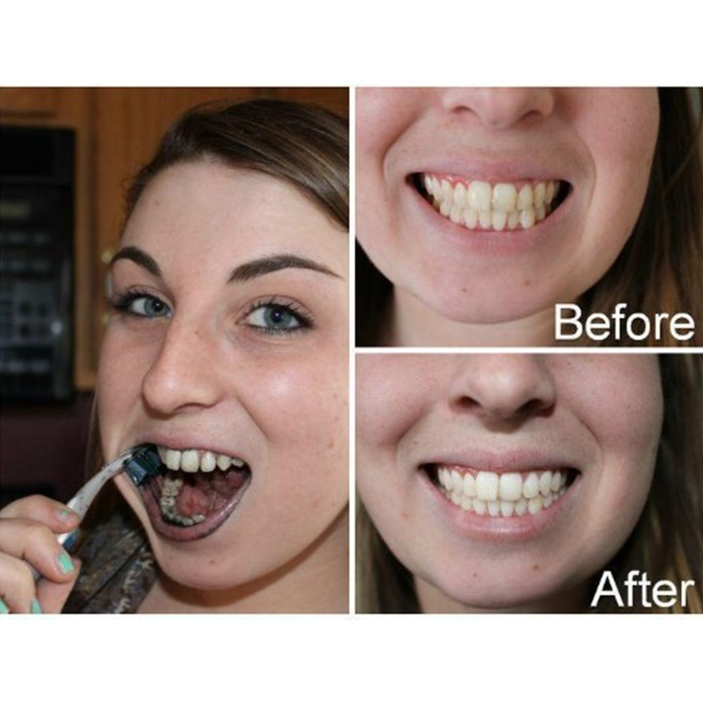 Bamboo Charcoal Teeth Tooth De - огляд і ціна Teeth Whitening Co