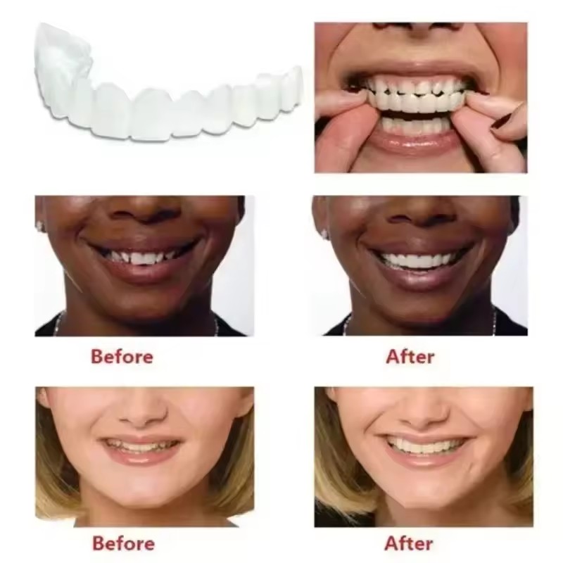 Reusable Temporary False Teeth - огляд і ціна Teeth Whitening Uneven