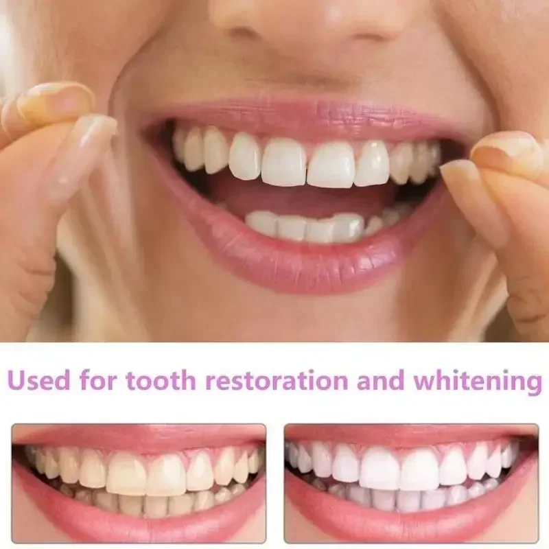 Charming Smile Teeth Veneers,  - огляд і ціна Teeth Whitening Uneven