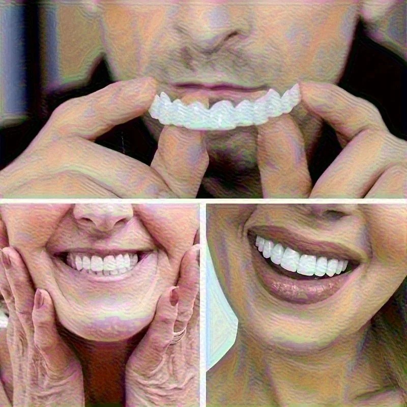 New Uneven Teeth Fix Veneers R - огляд і ціна Teeth Whitening Uneven