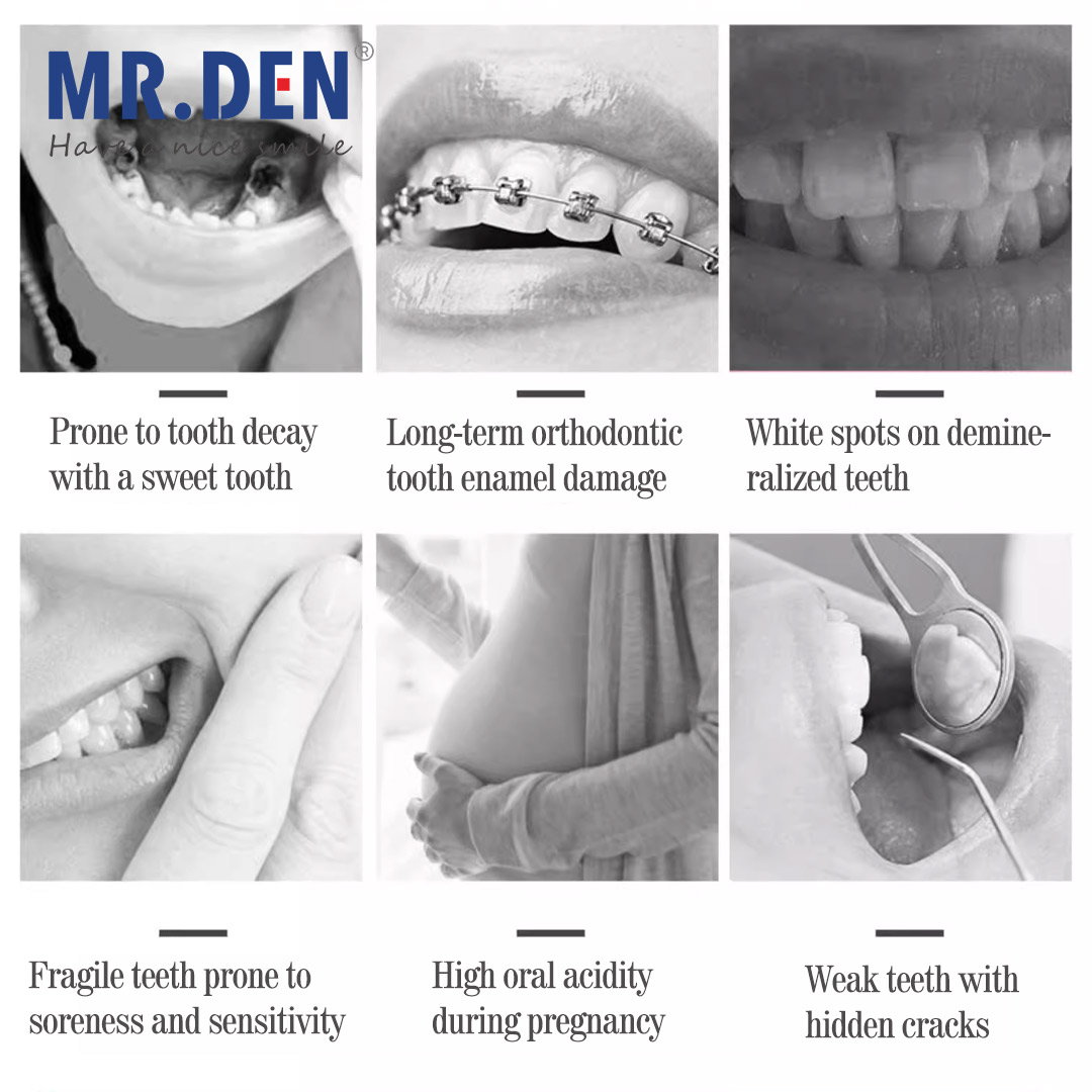 Japan GC Fluoride Enhanced Den - огляд і ціна Teeth Whitening Japan