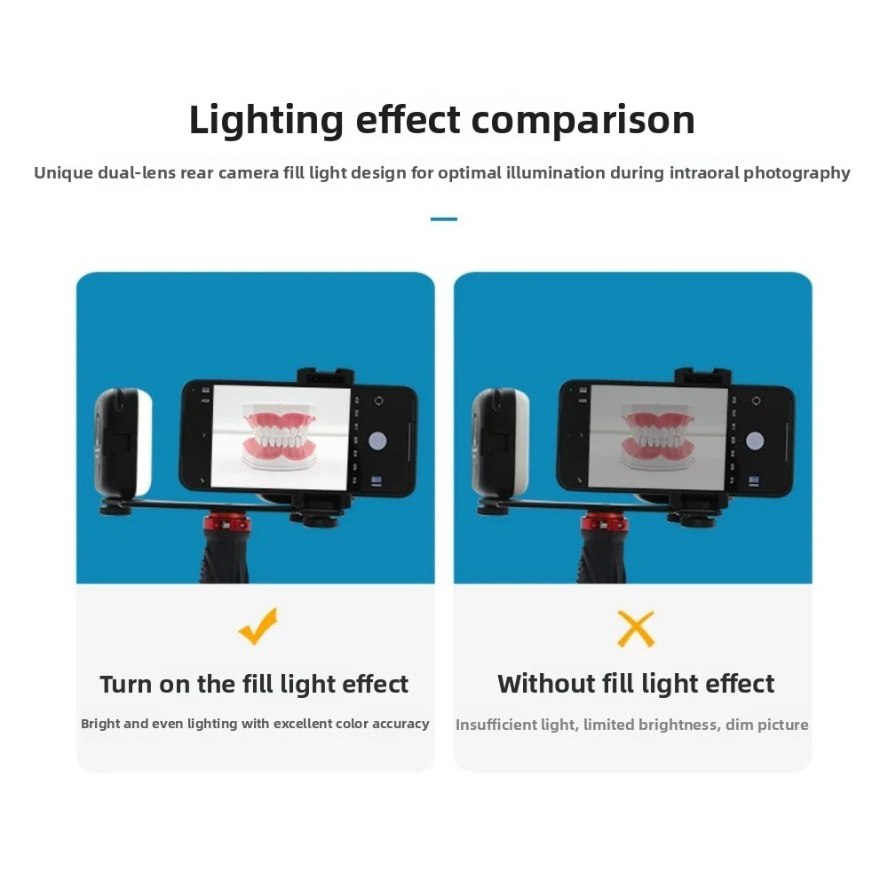 Dental Photography Light, Blue - огляд і ціна Teeth Whitening Flash