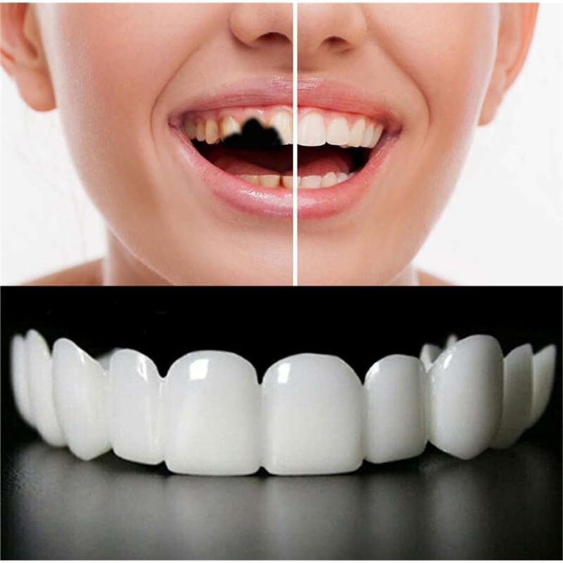 New Reusable Temporary False T - огляд і ціна Teeth Whitening Uneven