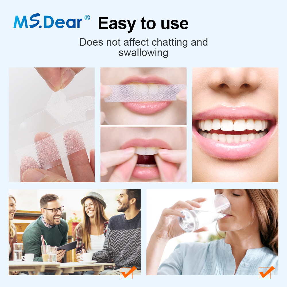 7/14/21/28/70 Pairs 9D Gel Tee - огляд і ціна Teeth Whitening Strips Crest