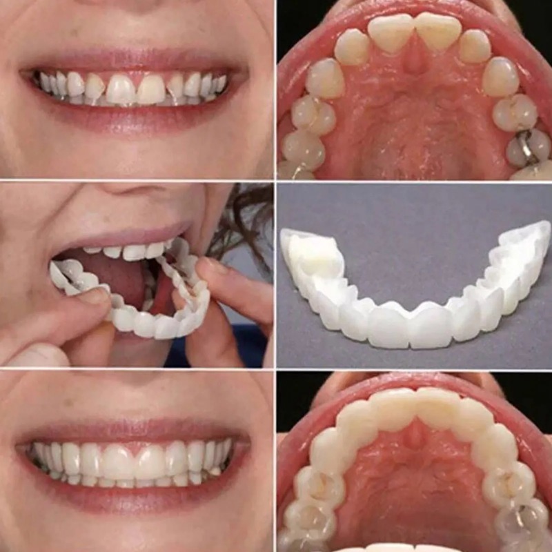 New Reusable Temporary False T - огляд і ціна Teeth Whitening Uneven